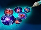 non-surgical joint pain injury