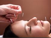 successful acupuncture clinic 37