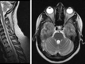 open mri diagnostic center